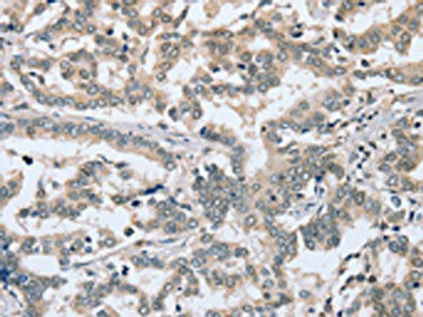 PTGER1 Antibody (PACO20289)