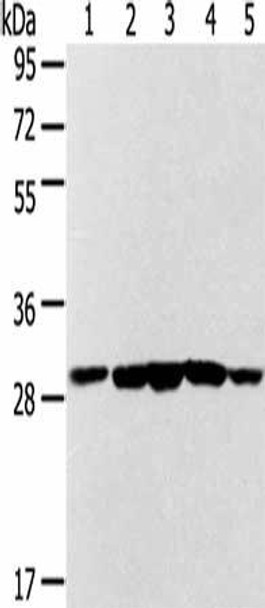 SDHB Antibody (PACO20414)