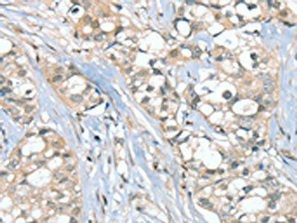 SGPL1 Antibody (PACO20452)