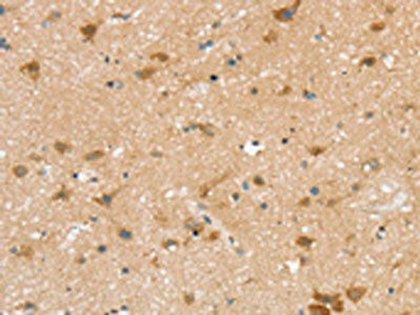 TBC1D4 Antibody (PACO20660)