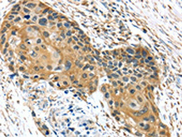 UBTD1 Antibody (PACO20809)