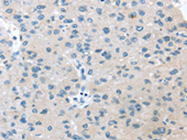 VPS4B Antibody (PACO20863)