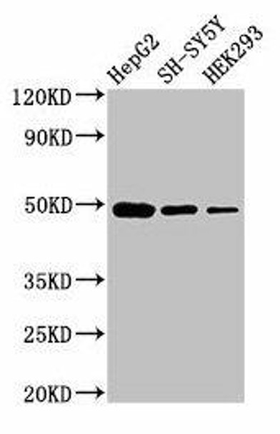 FDFT1 Antibody (PACO26717)