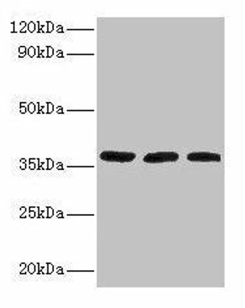 FTSJ1 Antibody (PACO26841)