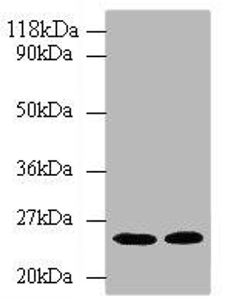 HMGCR Antibody (PACO27393)
