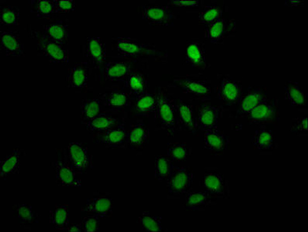 HNRNPA1 Antibody (PACO27401)