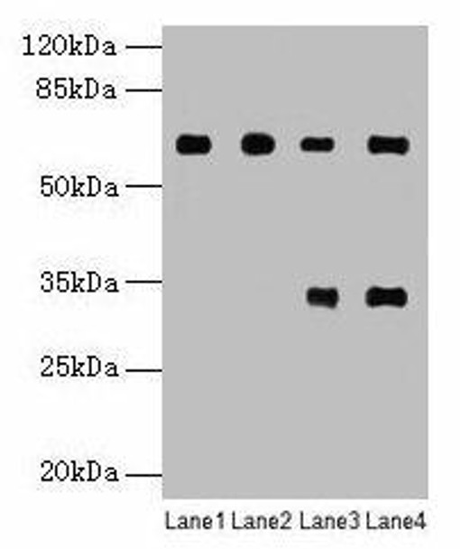 PGM1 Antibody (PACO28906)