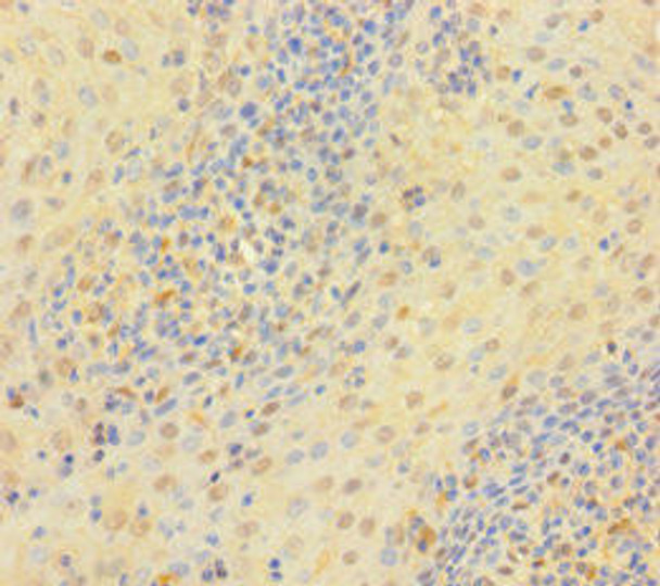TYMP Antibody (PACO30916)