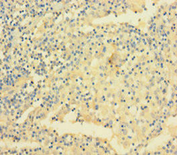 VAMP5 Antibody (PACO31032)