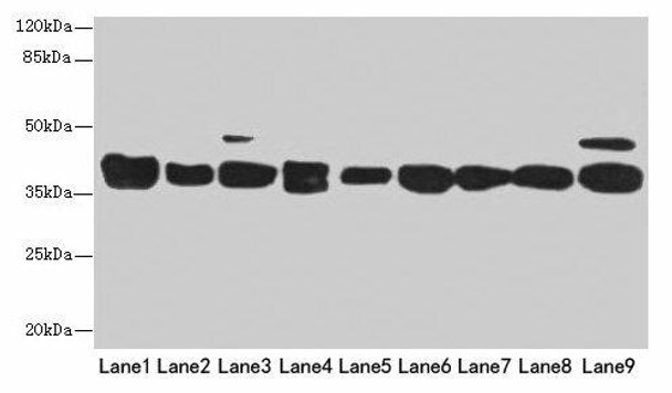 DNAJB1 Antibody (PACO31784)