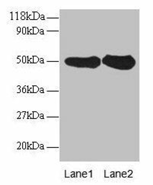 RPN1 Antibody (PACO31912)