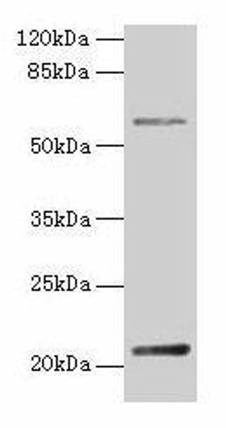 DUSP13 Antibody (PACO36634)