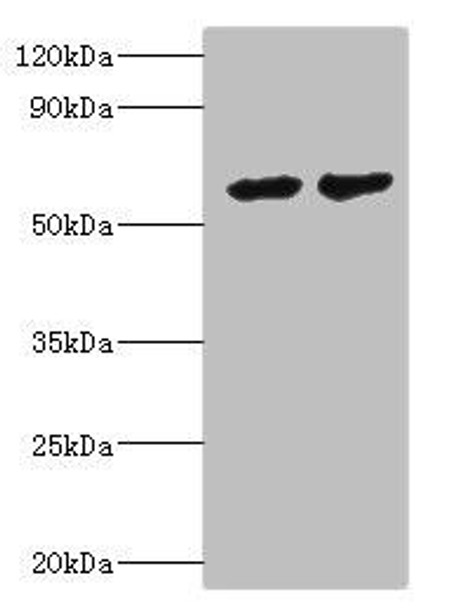 CYP4F12 Antibody (PACO43969)