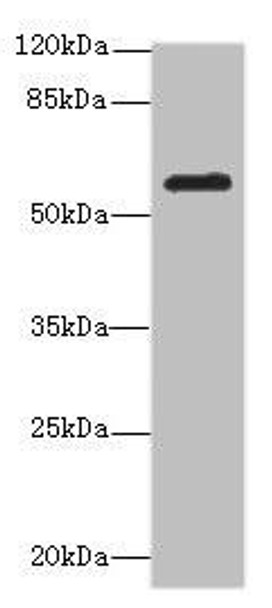 MMP19 Antibody (PACO44445)