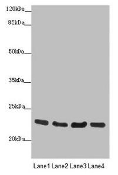 RAB18 Antibody (PACO45573)