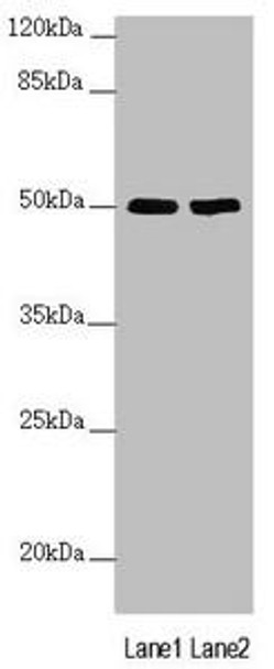SLC39A7 Antibody (PACO45628)
