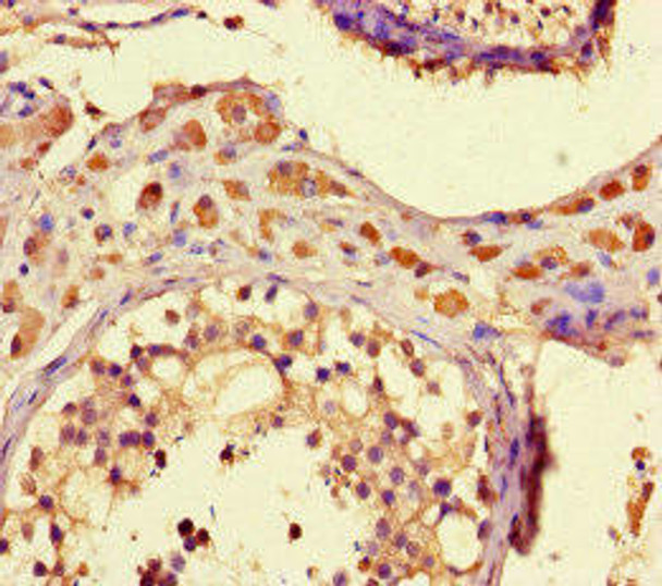 ZNF408 Antibody (PACO46338)