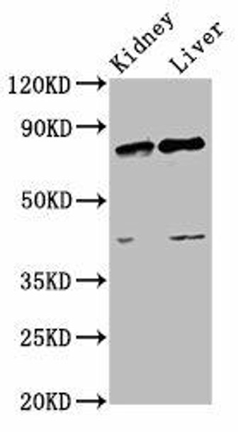 SUZ12 Antibody (PACO46538)