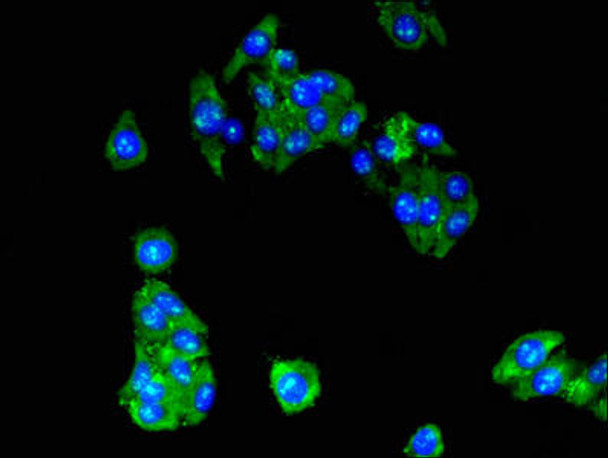 RPL10A Antibody (PACO53394)