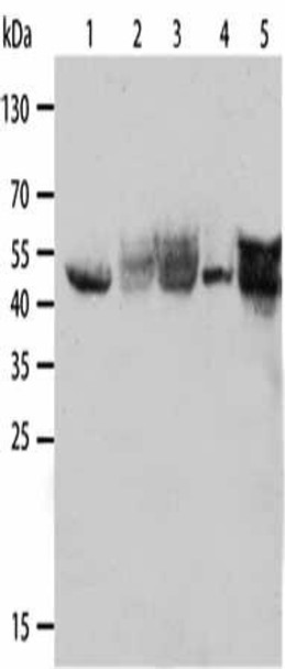 KRT19 Antibody (PACO14005)