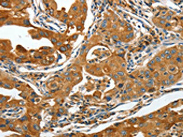 ANAPC10 Antibody (PACO15461)