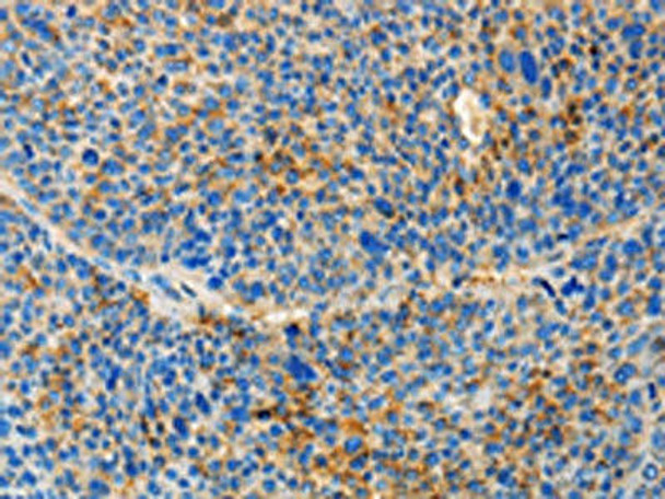 TNFSF13 Antibody (PACO15492)