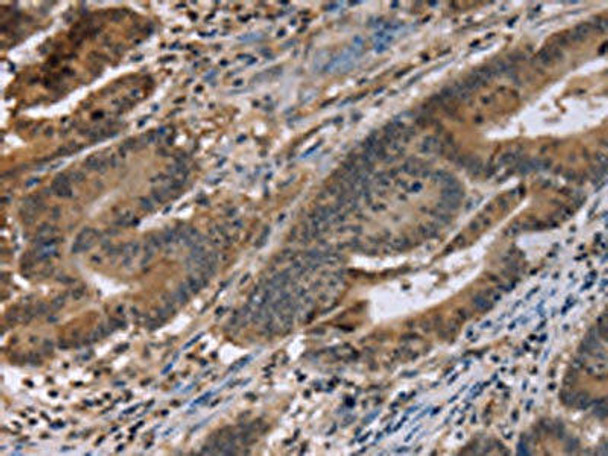 FAM107A Antibody (PACO16302)