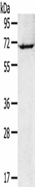 RAD17 Antibody (PACO16934)