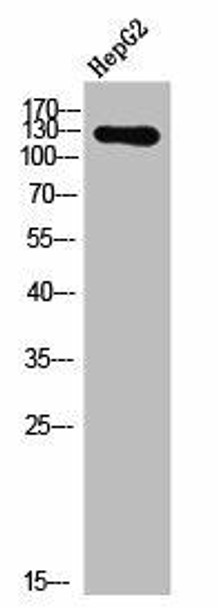 Phospho-EPHA2/EPHA3/EPHA4 (Y588/596) Antibody (PACO02630)