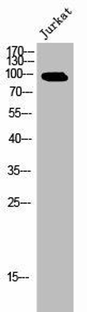 Phospho-EPS15 (Y849) Antibody (PACO02662)