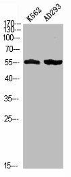 Phospho-MEF2D (S444) Antibody (PACO02899)