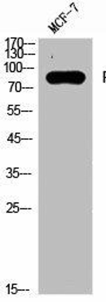 PRKCA/PRKCB/PRKCD/PRKCE/PRKCG/PRKCH/PRKCQ/PRKCZ Antibody (PACO06761)