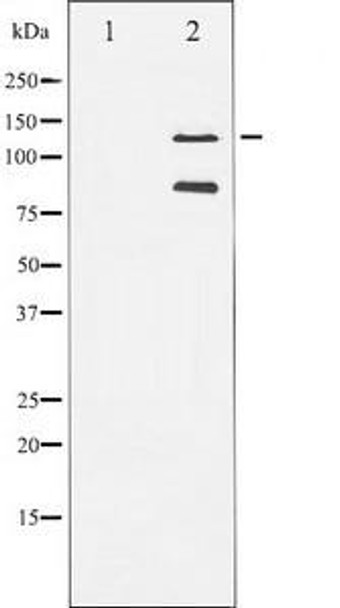 Cleaved-PARP1 (A214) Antibody (PACO21319)