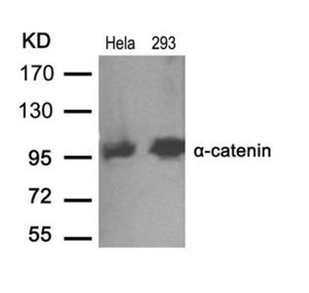 CTNNA1 (Ab-641) Antibody (PACO21421)