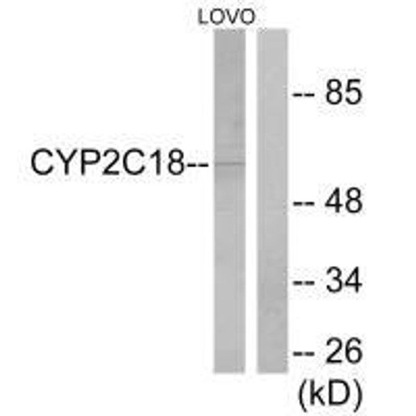 CYP2C18/CYP2C8/CYP2C9/CYP2C19 Antibody (PACO22047)