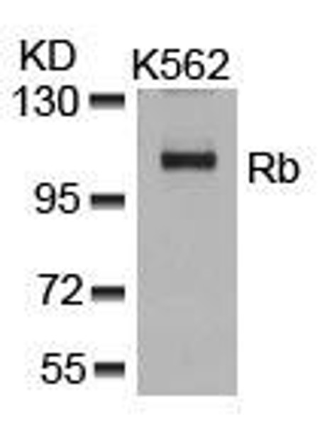 RB1 (Ab-807) Antibody (PACO22908)