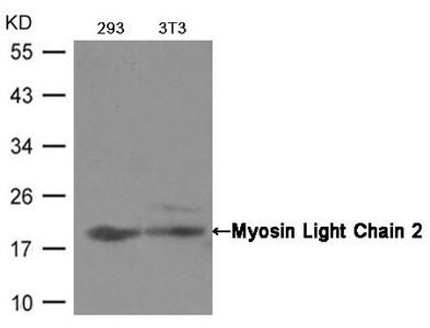 MYL9 (Ab-19) Antibody (PACO22928)