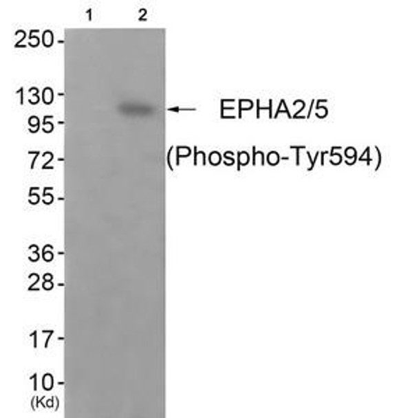 Phospho-EPHA2/EPHA5 (Tyr594) Antibody (PACO24176)