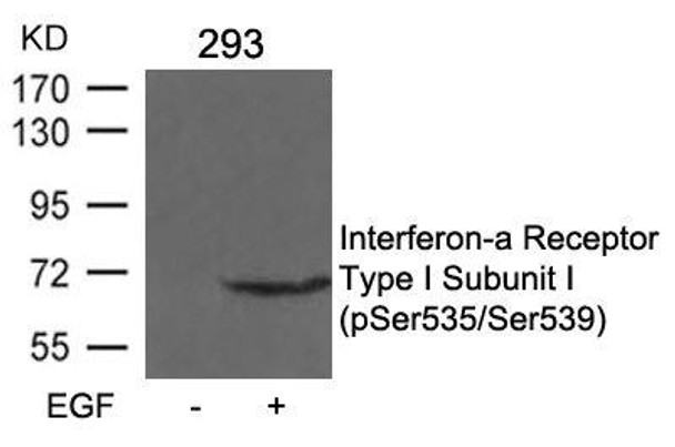 Phospho-IFNAR1 (Ser535/Ser539) Antibody (PACO24221)