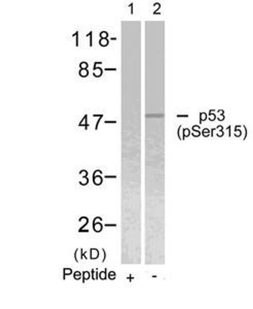 Phospho-TP53 (Ser315) Antibody (PACO24458)