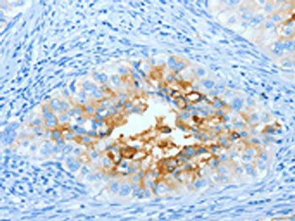 CEACAM5 Antibody (PACO13767)