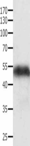 ACTG1 Antibody (PACO13818)