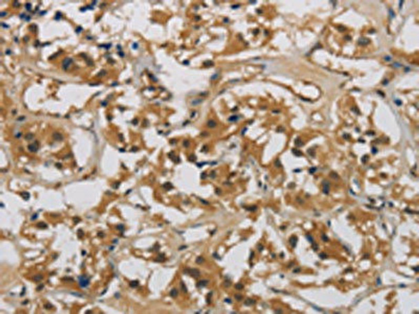 CASP9 Antibody (PACO13867)