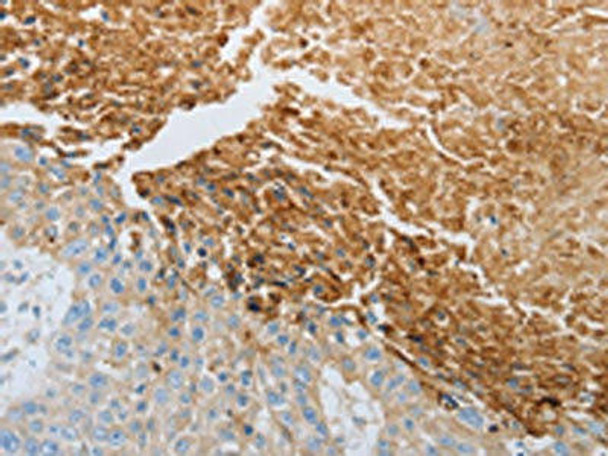 RTN4 Antibody (PACO18764)