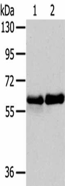 PAK3 Antibody (PACO18807)