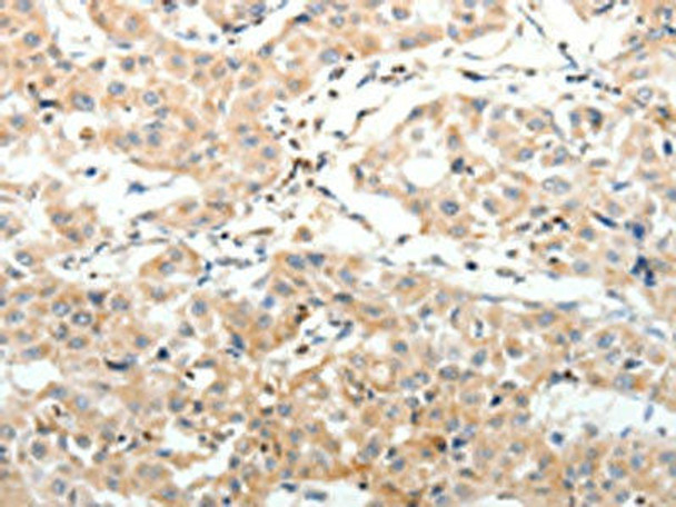 SV2A Antibody (PACO18945)