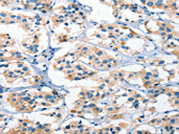 AHR Antibody (PACO19283)