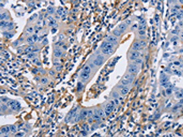 ICAM1 Antibody (PACO19433)