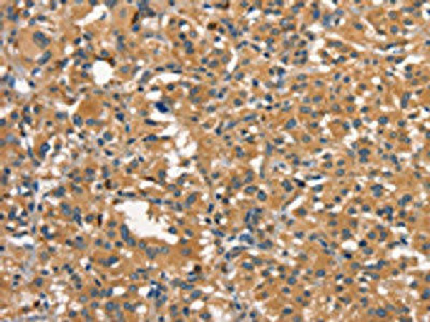 DNM2 Antibody (PACO19586)