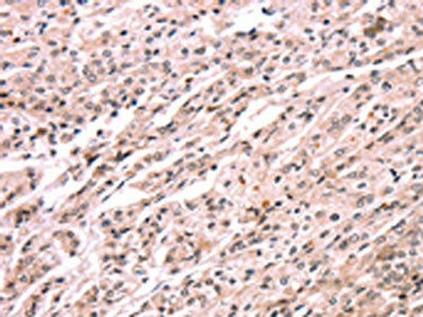 EXTL1 Antibody (PACO19637)